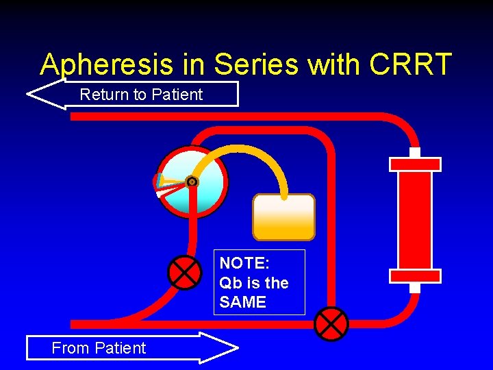 Apheresis in Series with CRRT Return to Patient NOTE: Qb is the SAME From