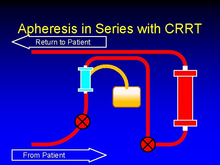 Apheresis in Series with CRRT Return to Patient From Patient 