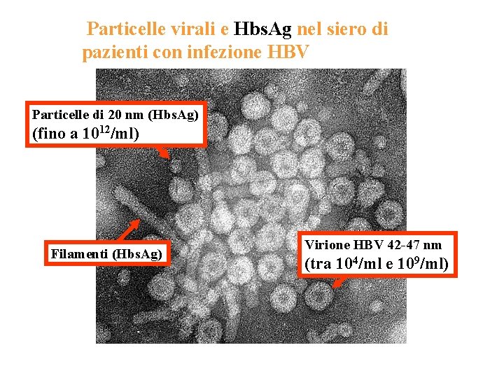 Particelle virali e Hbs. Ag nel siero di pazienti con infezione HBV Particelle di