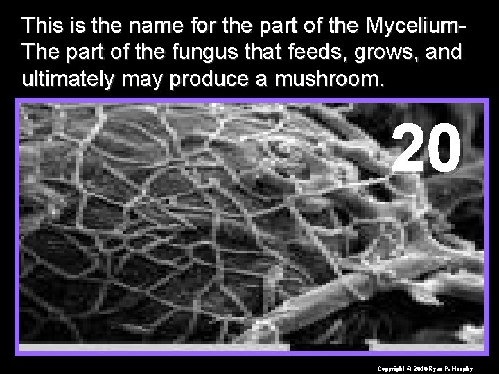 This is the name for the part of the Mycelium. The part of the