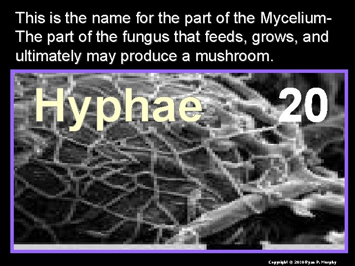 This is the name for the part of the Mycelium. The part of the