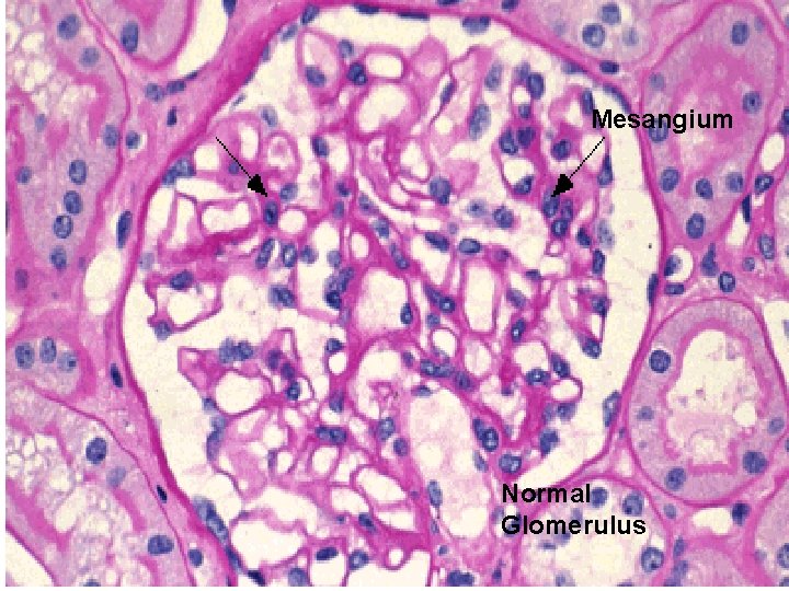 Mesangium Normal Glomerulus 