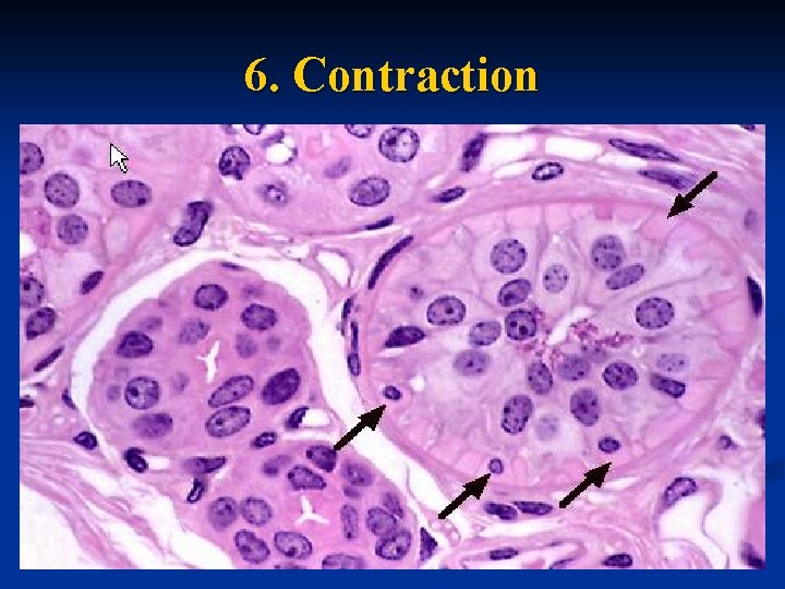 6. Contraction 