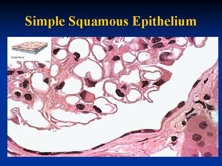 Simple Squamous Epithelium 