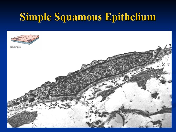 Simple Squamous Epithelium 