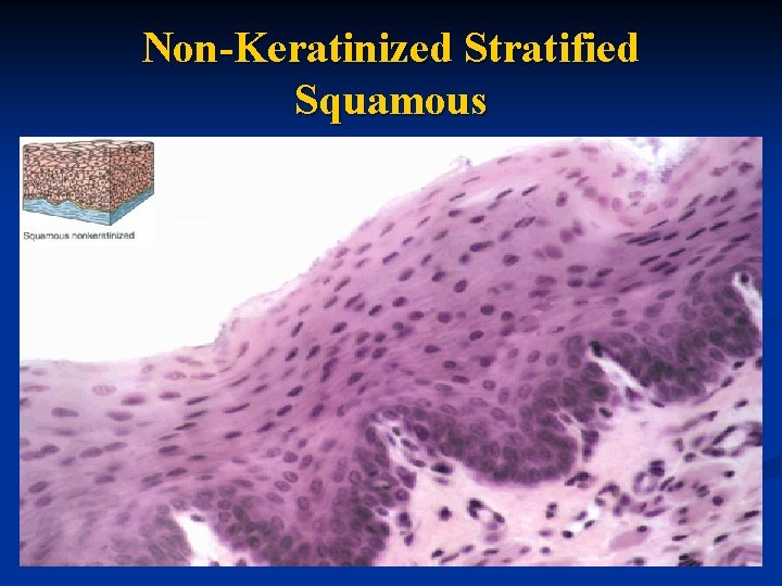 Non-Keratinized Stratified Squamous 