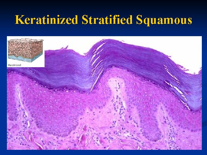 Keratinized Stratified Squamous 