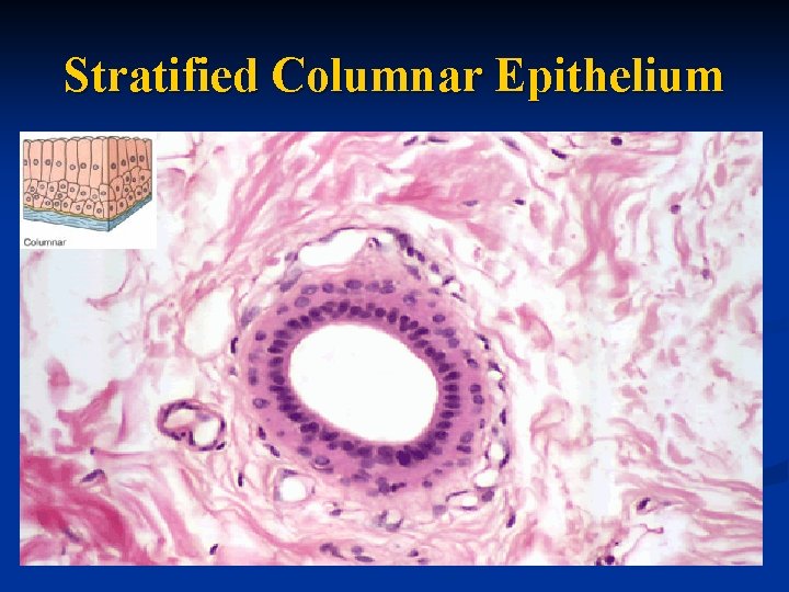 Stratified Columnar Epithelium 