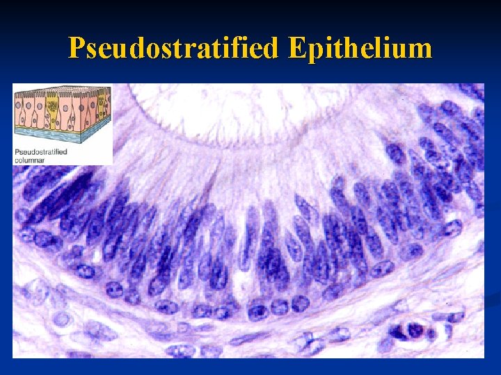 Pseudostratified Epithelium 
