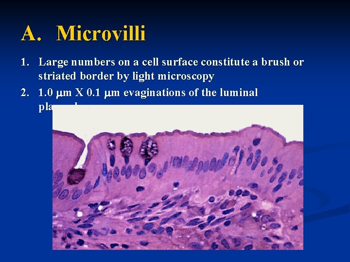 A. Microvilli 1. Large numbers on a cell surface constitute a brush or striated