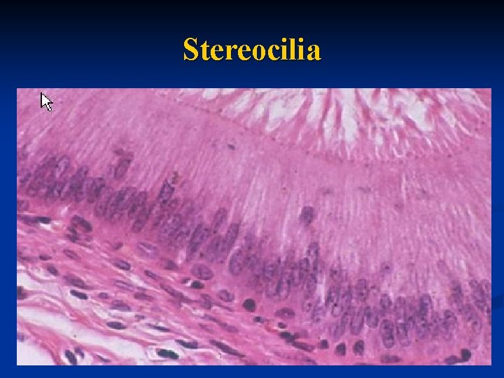 Stereocilia 
