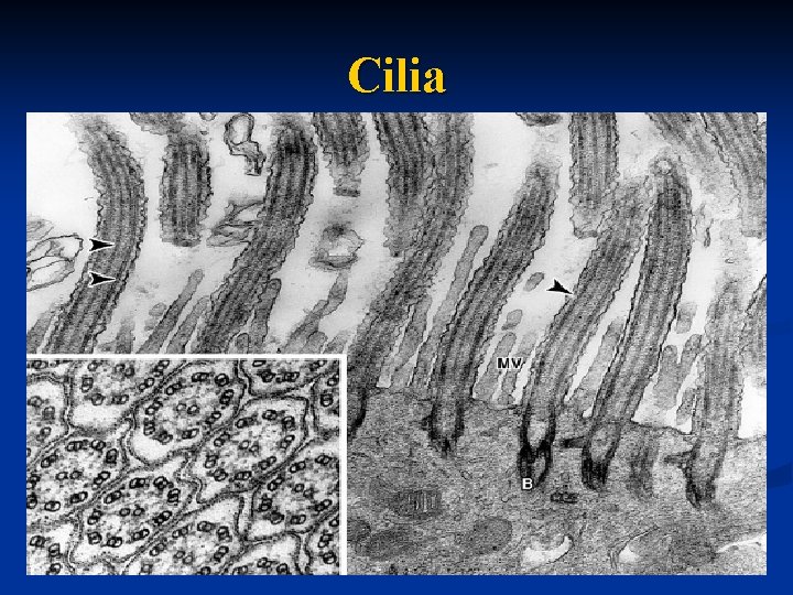 Cilia 