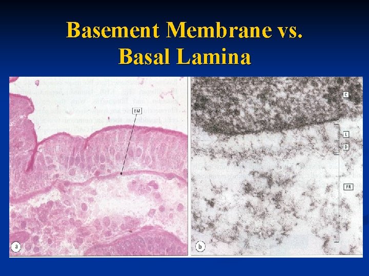 Basement Membrane vs. Basal Lamina 