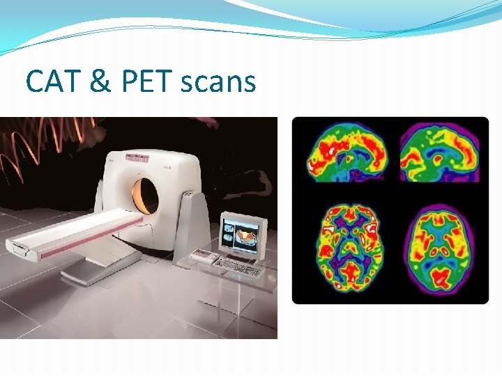 CAT & PET scans 