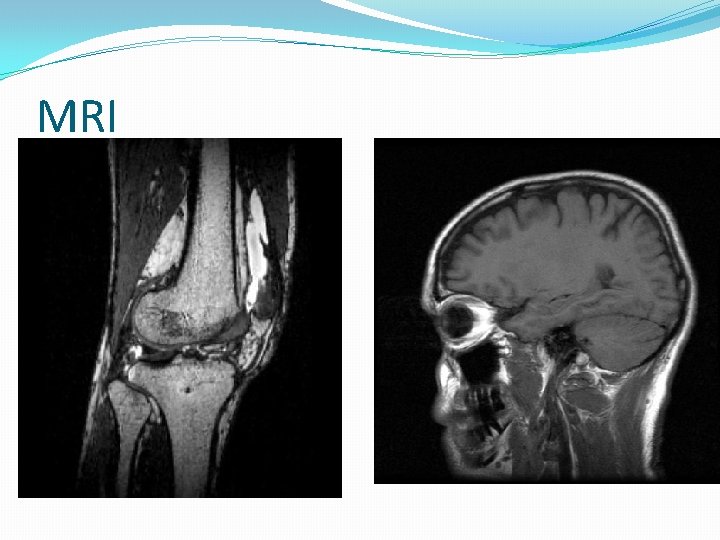 MRI 
