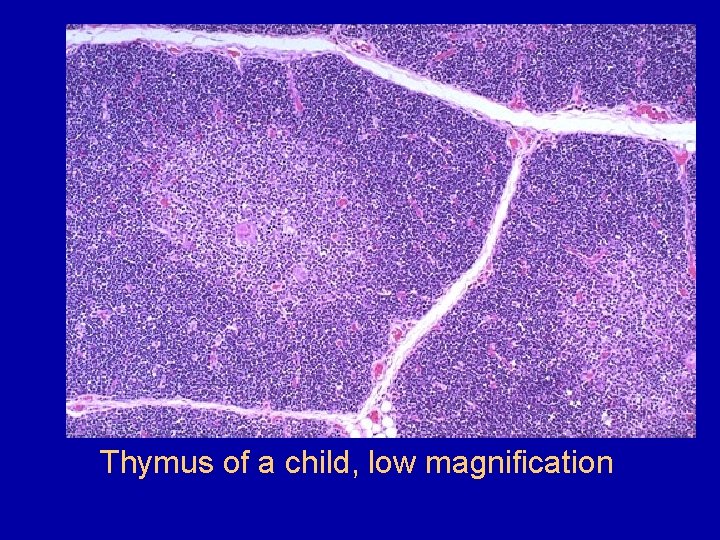 Thymus of a child, low magnification 