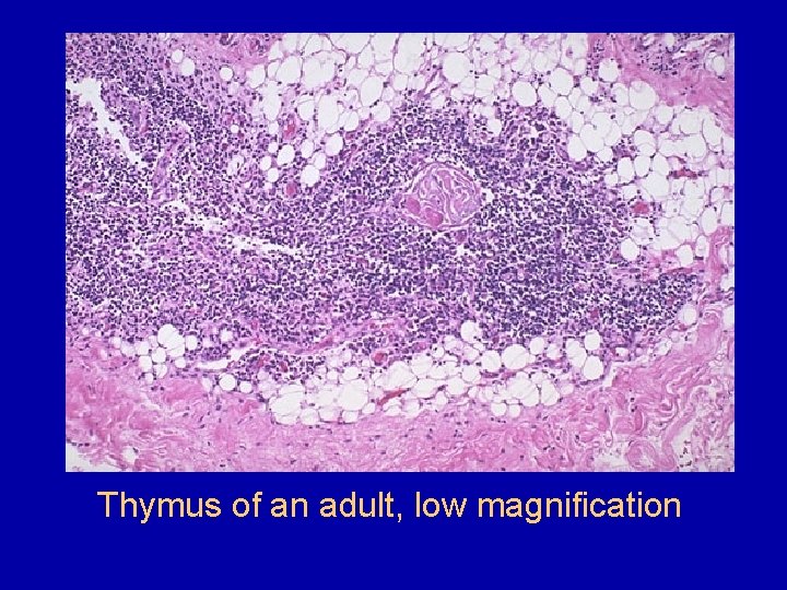 Thymus of an adult, low magnification 