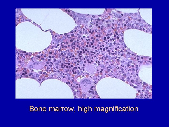 Bone marrow, high magnification 