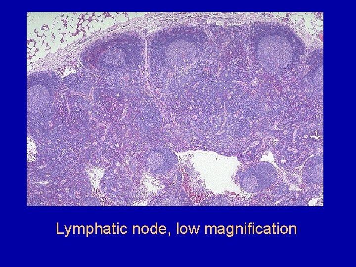 Lymphatic node, low magnification 