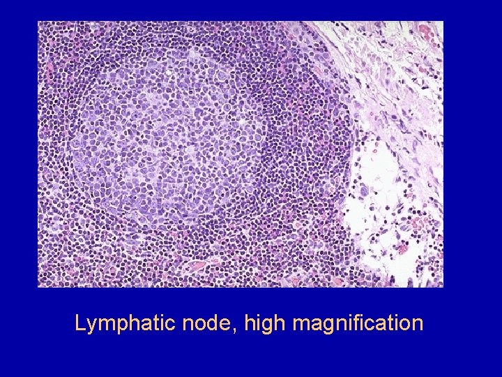 Lymphatic node, high magnification 
