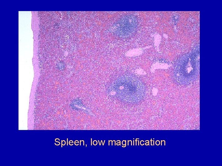 Spleen, low magnification 