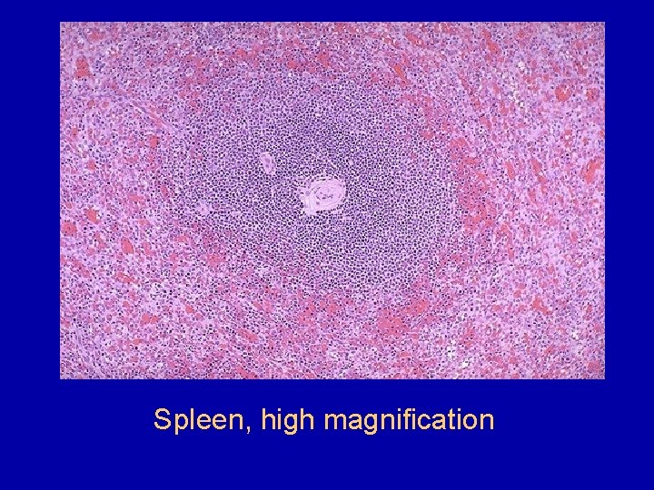 Spleen, high magnification 