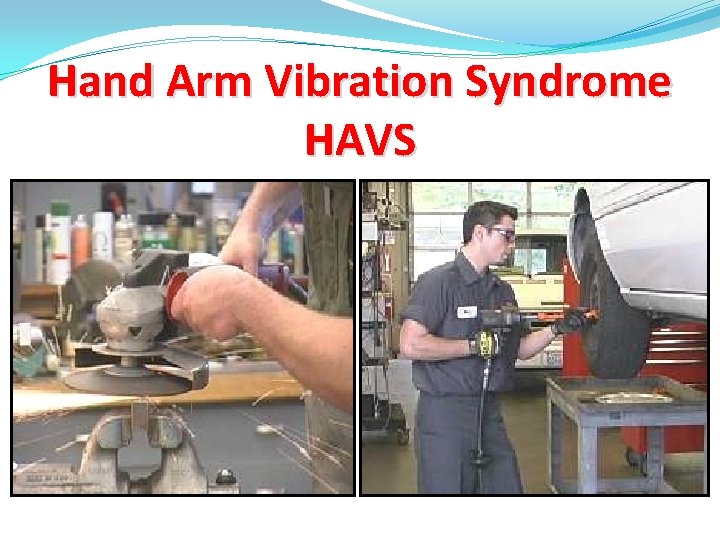 Hand Arm Vibration Syndrome HAVS 