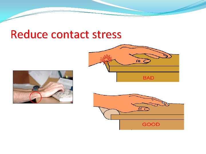 Reduce contact stress 