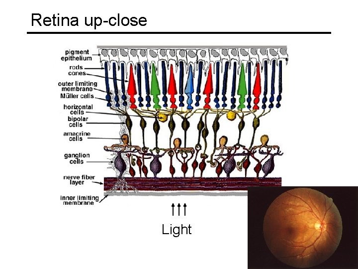 Retina up-close Light Retina up-close Light