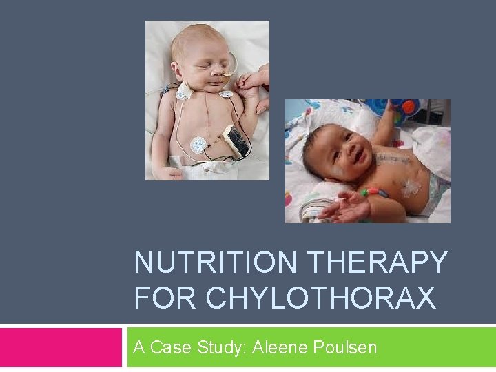 NUTRITION THERAPY FOR CHYLOTHORAX A Case Study: Aleene Poulsen 