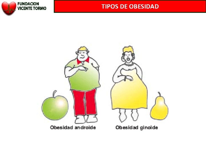 TIPOS DE OBESIDAD 