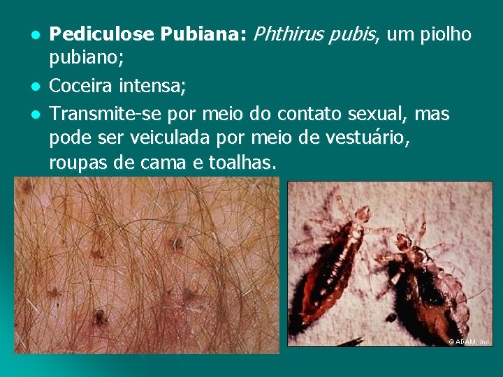 l l l Pediculose Pubiana: Phthirus pubis, um piolho pubiano; Coceira intensa; Transmite-se por