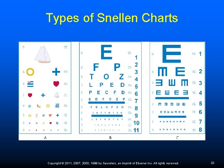 Types of Snellen Charts Copyright © 2011, 2007, 2003, 1999 by Saunders, an imprint