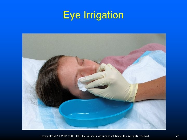 Eye Irrigation Copyright © 2011, 2007, 2003, 1999 by Saunders, an imprint of Elsevier