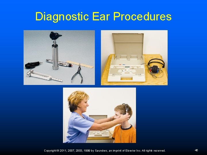 Diagnostic Ear Procedures Copyright © 2011, 2007, 2003, 1999 by Saunders, an imprint of