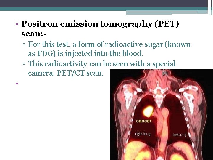  • Positron emission tomography (PET) scan: ▫ For this test, a form of