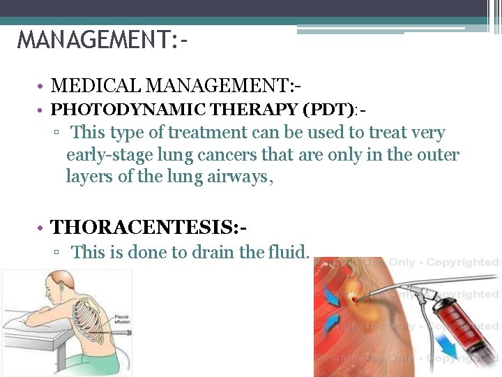 MANAGEMENT: • MEDICAL MANAGEMENT: • PHOTODYNAMIC THERAPY (PDT): - ▫ This type of treatment