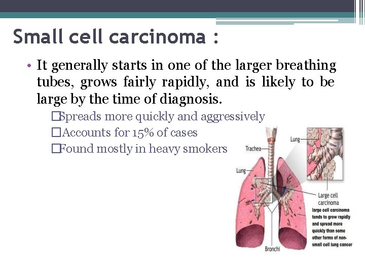 Small cell carcinoma : • It generally starts in one of the larger breathing