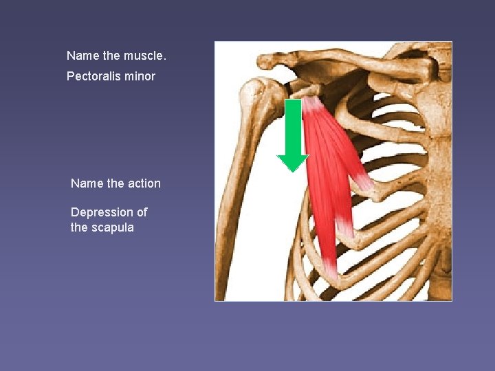 Name the muscle. Pectoralis minor Name the action Depression of the scapula 