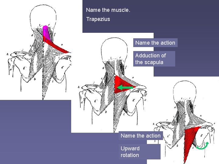 Name the muscle. Trapezius Name the action Adduction of the scapula Name the action