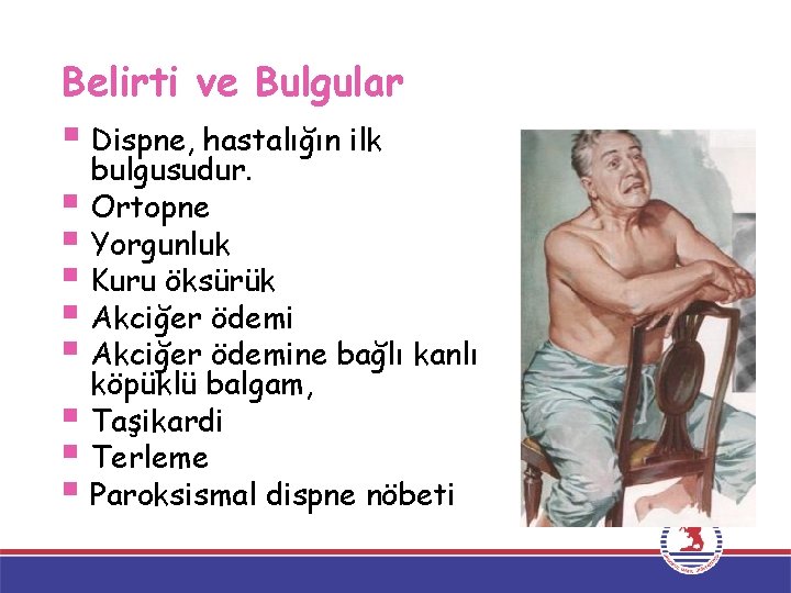 Belirti ve Bulgular § Dispne, hastalığın ilk § § § § bulgusudur. Ortopne Yorgunluk