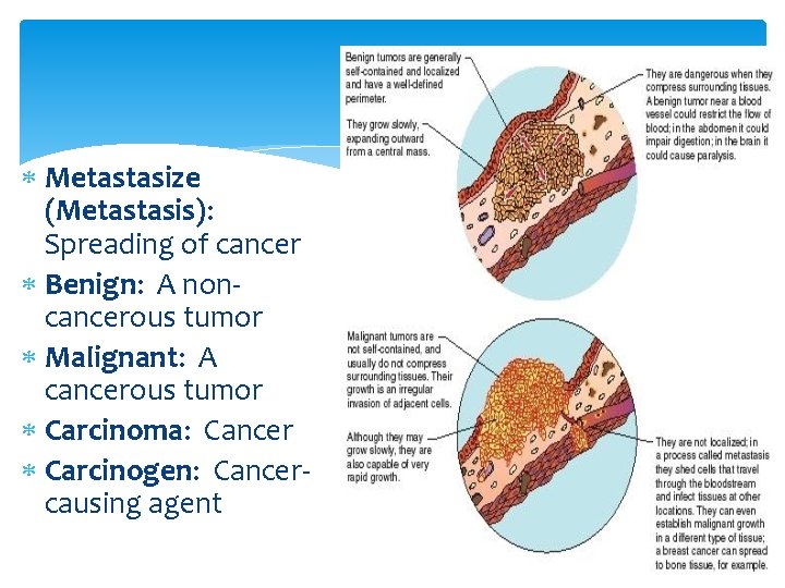  Metastasize (Metastasis): Spreading of cancer Benign: A noncancerous tumor Malignant: A cancerous tumor