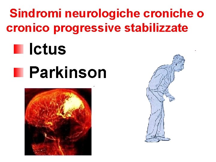 Sindromi neurologiche croniche o cronico progressive stabilizzate Ictus Parkinson 