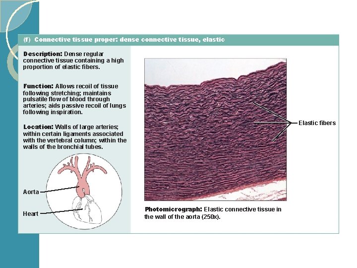 (f) Connective tissue proper: dense connective tissue, elastic Description: Dense regular connective tissue containing