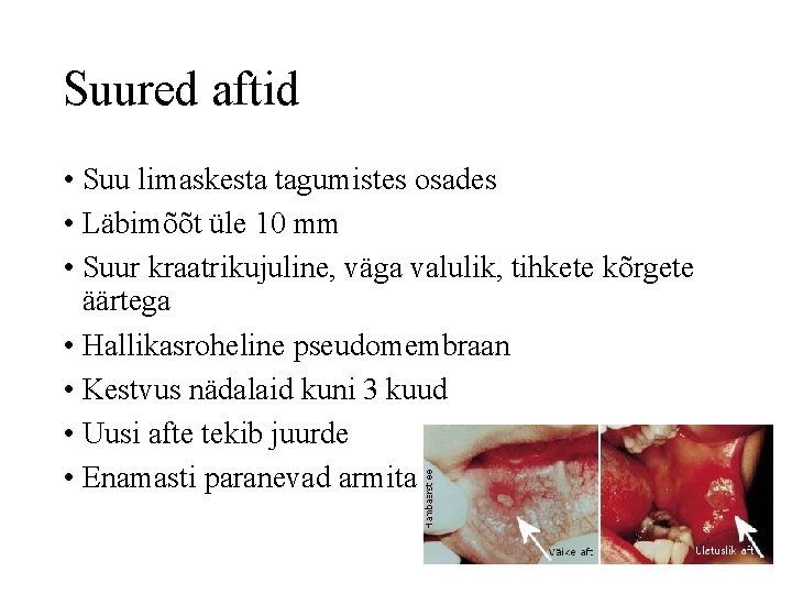 Suured aftid • Suu limaskesta tagumistes osades • Läbimõõt üle 10 mm • Suur