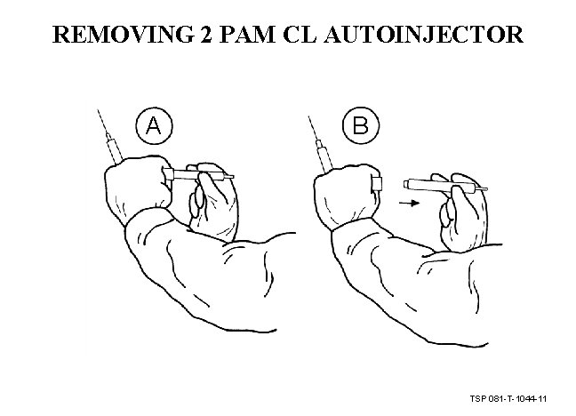 REMOVING 2 PAM CL AUTOINJECTOR A B TSP 081 -T-1044 -11 