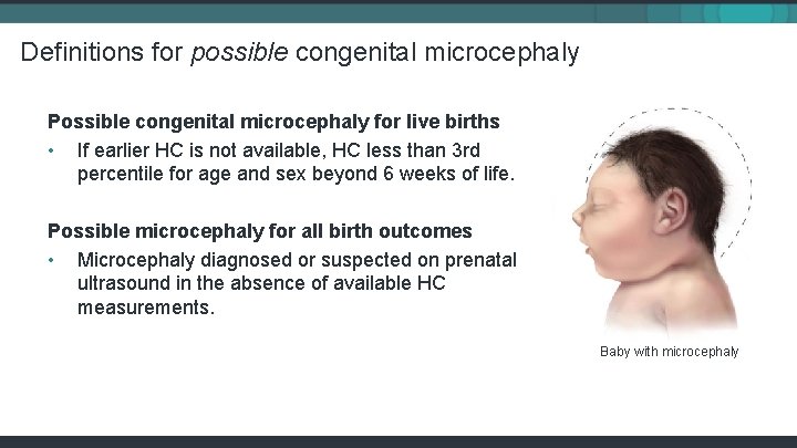 Definitions for possible congenital microcephaly Possible congenital microcephaly for live births • If earlier