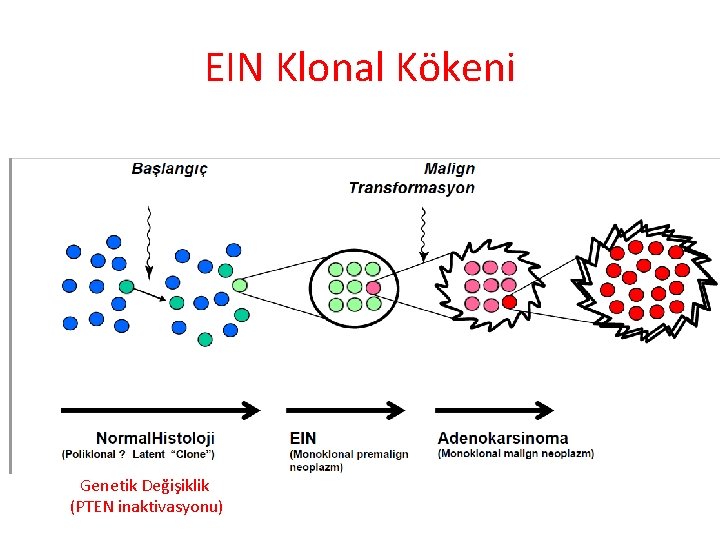 EIN Klonal Kökeni Genetik Değişiklik (PTEN inaktivasyonu) 