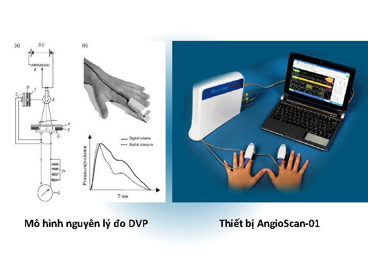 Mô hình nguyên lý đo DVP Thiết bị Angio. Scan-01 