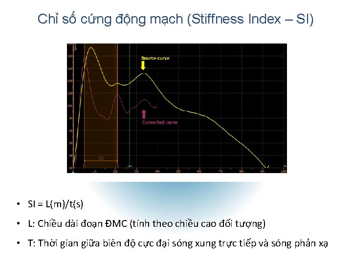 Chỉ số cứng động mạch (Stiffness Index – SI) • SI = L(m)/t(s) •